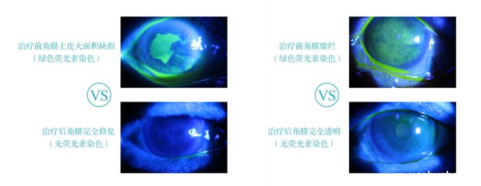 干眼病专科简介