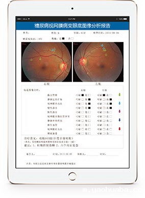 糖尿病视网膜病变远程诊断服务