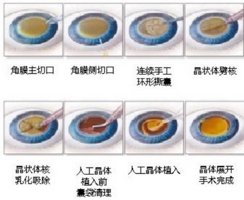 365足球盘口网站超声乳化技术